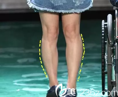 瘦臉除皺瘦小腿—韓國365mc醫(yī)院