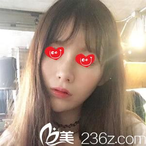 我去韓國陳整形找了陳世勛院長之后才發(fā)現(xiàn)其實(shí)祛痘坑也沒那么難