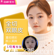 濟(jì)南海峽全切雙眼皮案例