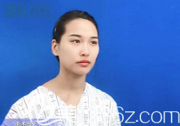 手術(shù)當(dāng)天我的面部狀態(tài)