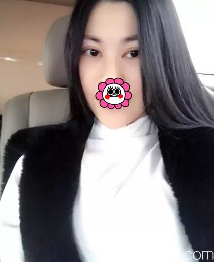 常熟時代黎曄主任分享割雙眼皮實例，經(jīng)驗豐富的醫(yī)生能做到術(shù)后半個月閉眼只有淡淡的細(xì)痕