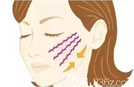 面部線雕之后會導(dǎo)致面部變得僵硬嗎？