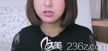 下顎矯正手術(shù)術(shù)后一年的樣子