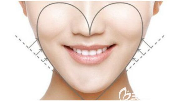 蘋果肌的準(zhǔn)確位置介紹