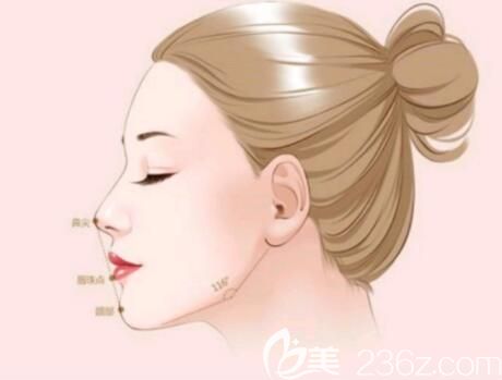 墊下巴假體好還是注射玻尿酸好？