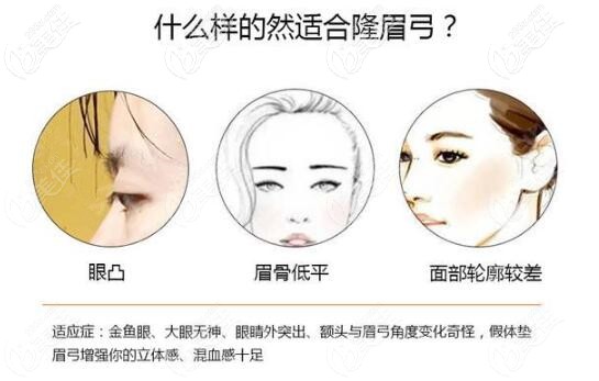 什么樣的人適合隆眉弓