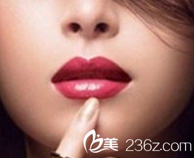 進行唇部整形之前有哪些事項是需要知道的？